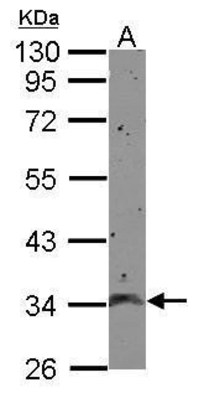 100uL Polyclonal antibody, CCDC90A, host