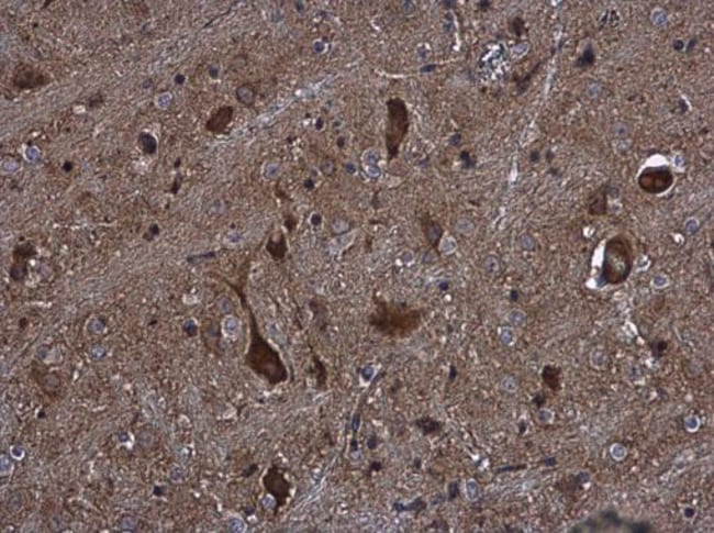 100uL Polyclonal antibody, KIFC2, host r