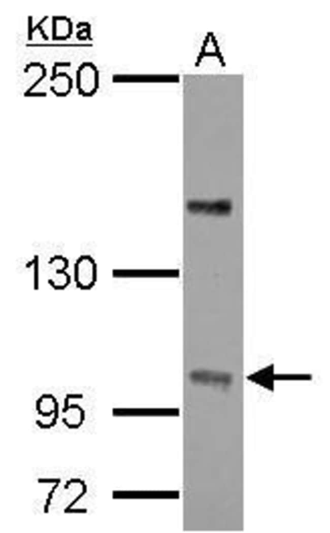 100uL Polyclonal antibody, PP4R4, host r