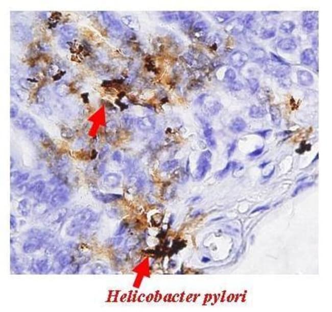 ANTI-HELICOBACTER PYLORI UREASE B