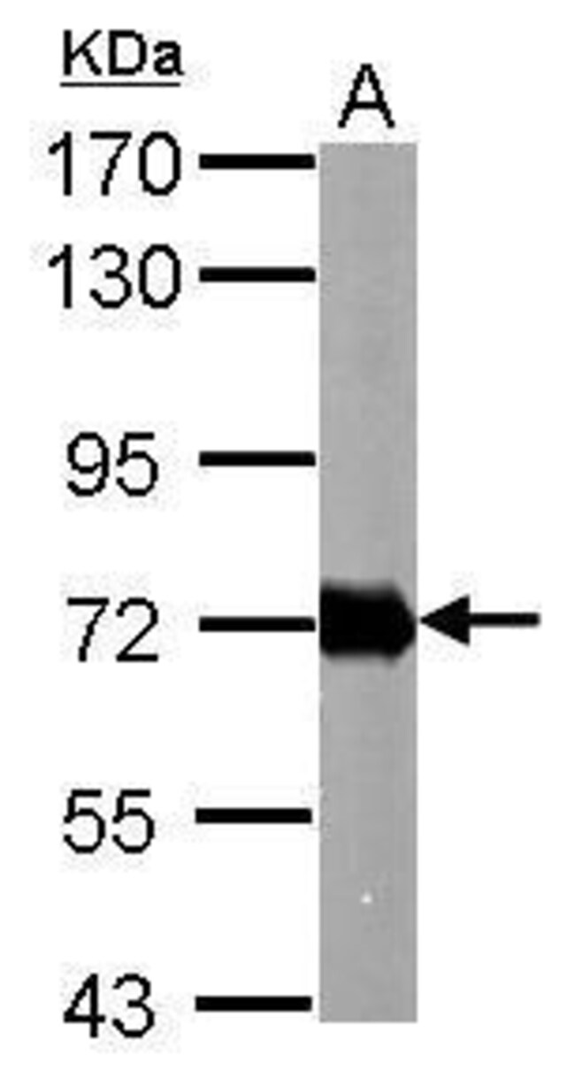 ANTI-HELICOBACTER PYLORI UREASE B
