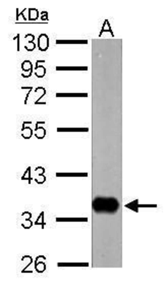 100uL Polyclonal antibody, nrv1, host ra