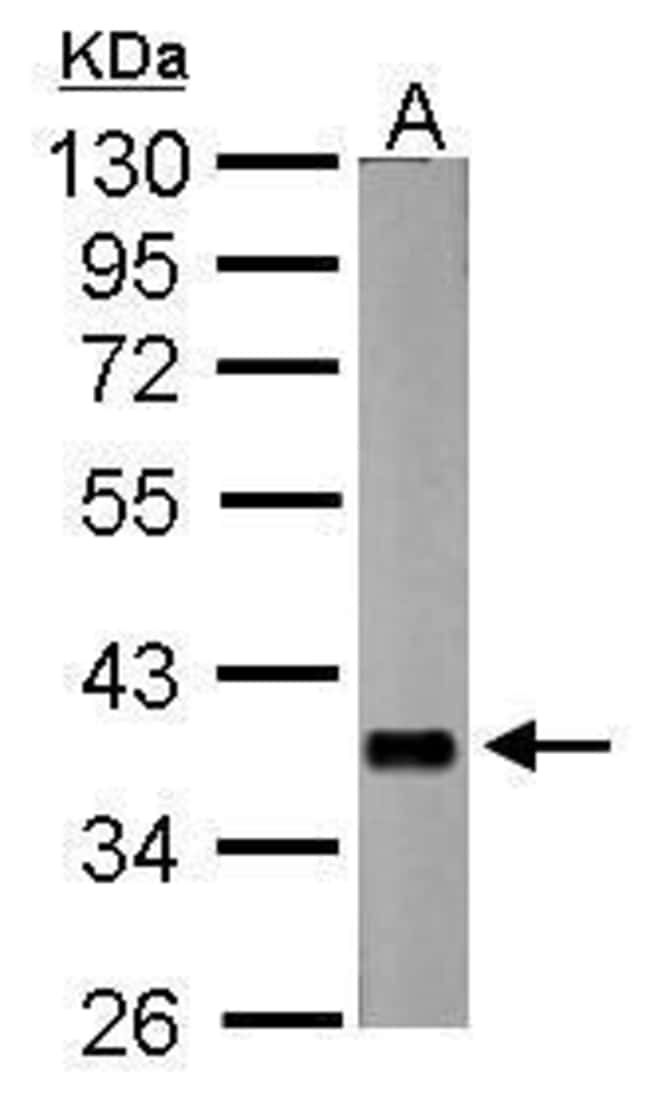 100uL Polyclonal antibody, nrv2.1, host