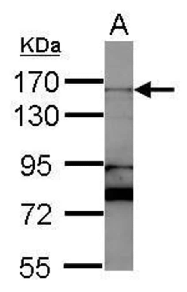 100uL Polyclonal antibody, RAD50, host r