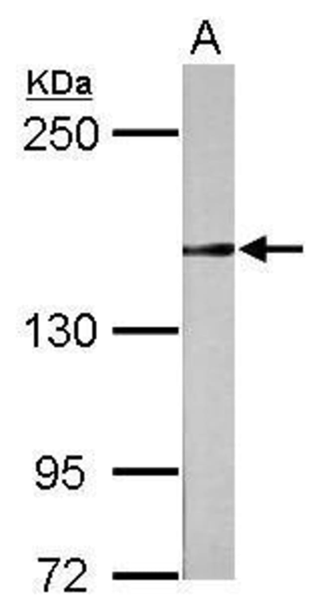 100uL Polyclonal antibody, RAD50, host r
