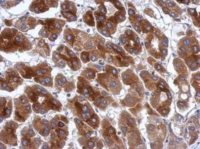 100uL Polyclonal antibody, protor 1, hos