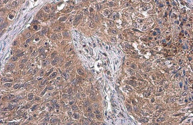 100uL Polyclonal antibody, ATG12, host r