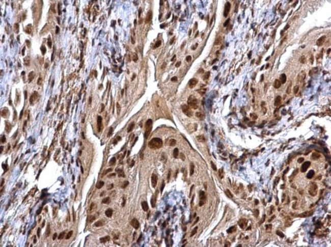 100uL Polyclonal antibody, CHD4, host ra
