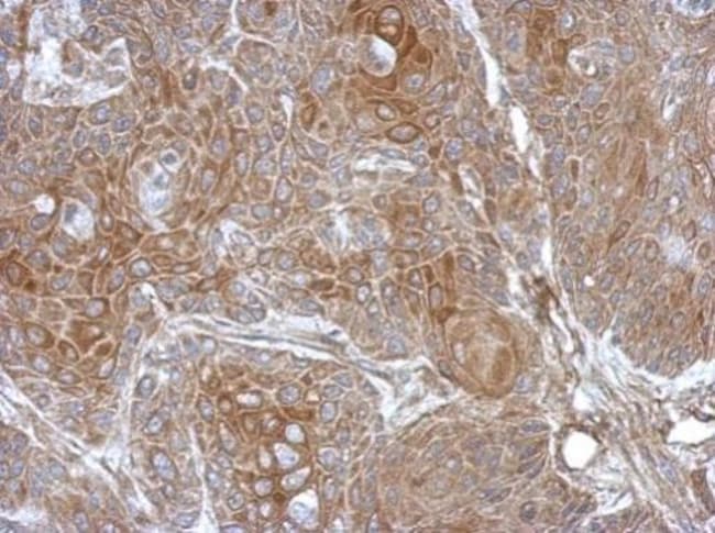 100uL Polyclonal antibody, DZIP3, host r