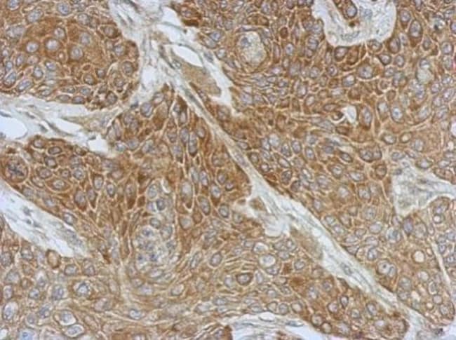 100uL Polyclonal antibody, DZIP3, host r