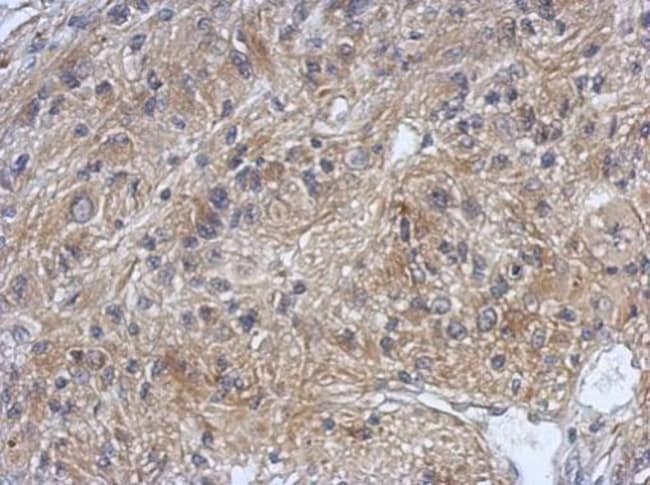 100uL Polyclonal antibody, DZIP3, host r