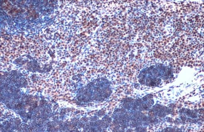 100uL Polyclonal antibody, JMJD3, host r
