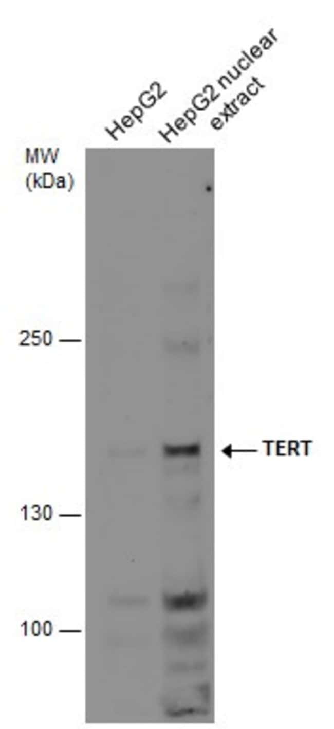 100uL Polyclonal antibody, TERT, host ra