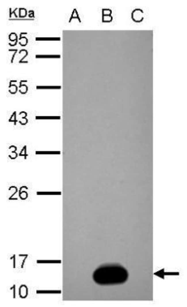 100uL Polyclonal antibody, NS2B (Dengue