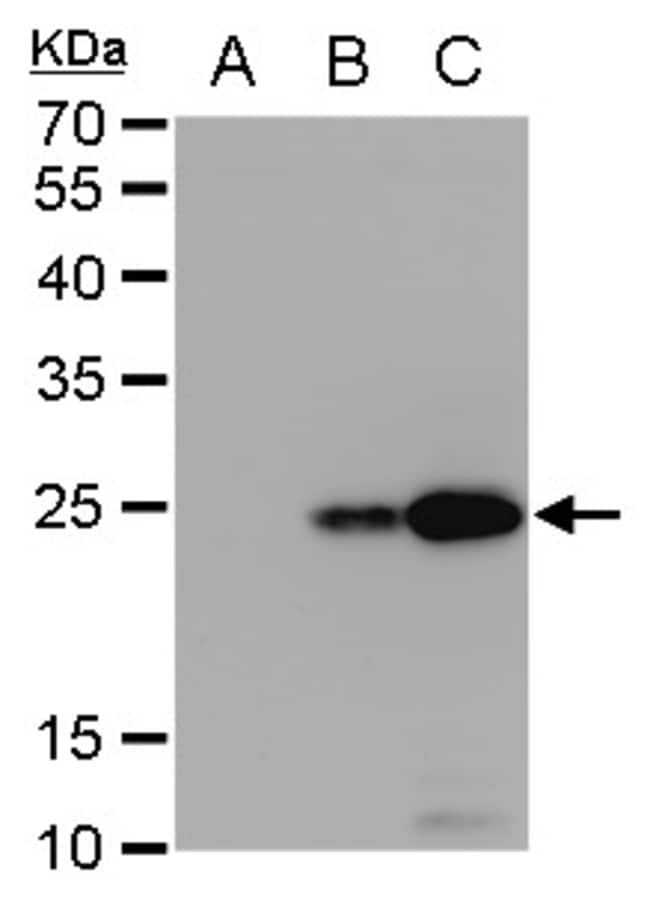 100uL Polyclonal antibody, NS4B (Dengue