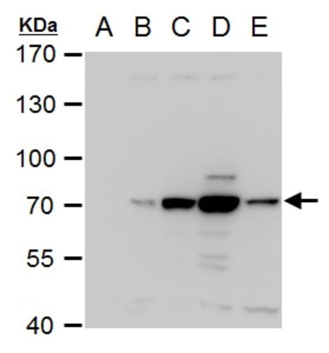 100uL Polyclonal antibody, NS3 (Dengue v