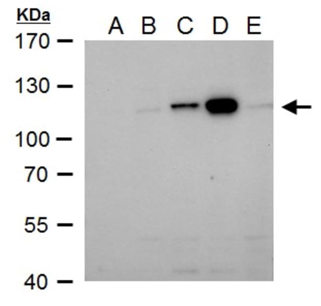 100uL Polyclonal antibody, NS5 (Dengue v