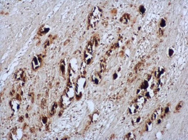 100uL Polyclonal antibody, EV71, host ra