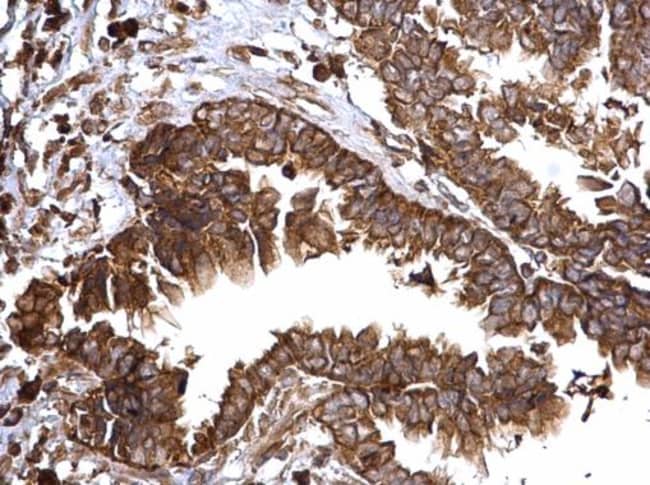100uL Polyclonal antibody, Bcl-xs, host