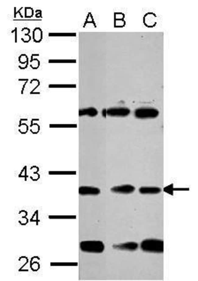 100uL Polyclonal antibody, neuro D1, hos
