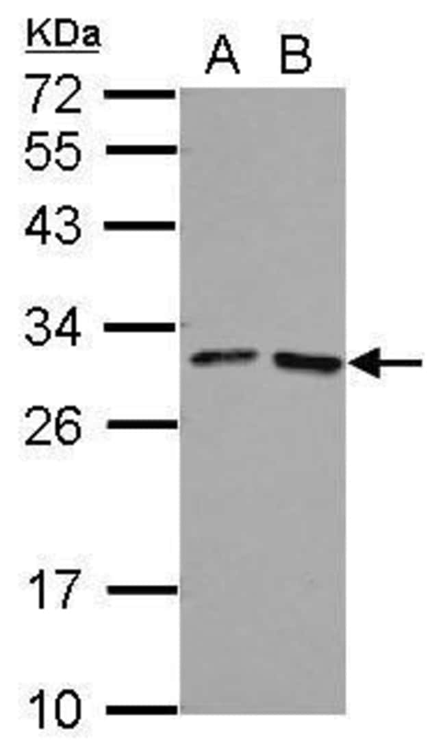 100uL Polyclonal antibody, FOLR4, host r