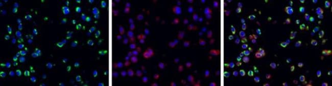 100uL Polyclonal antibody, NS1 (Dengue v