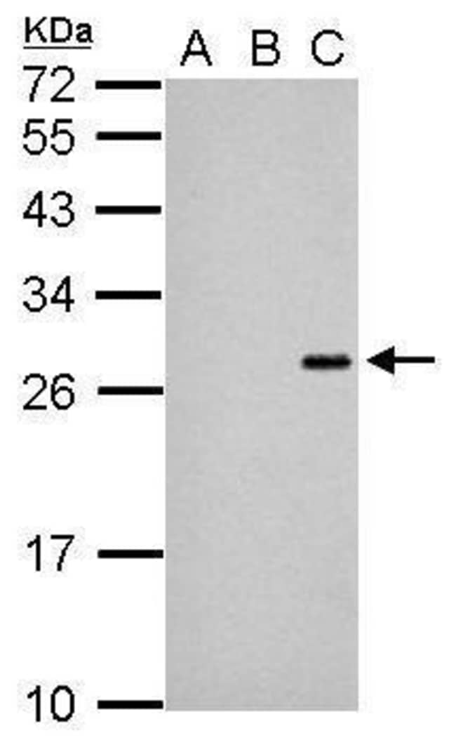 100UL Japanese Encephalitis Virus NS4B A