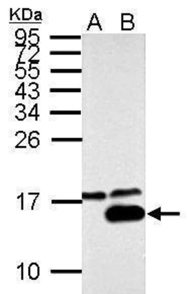 100uL Polyclonal antibody, galectin7, ho