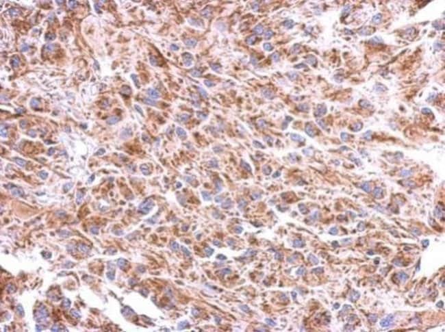 100uL Polyclonal antibody, ST8SIA4, host
