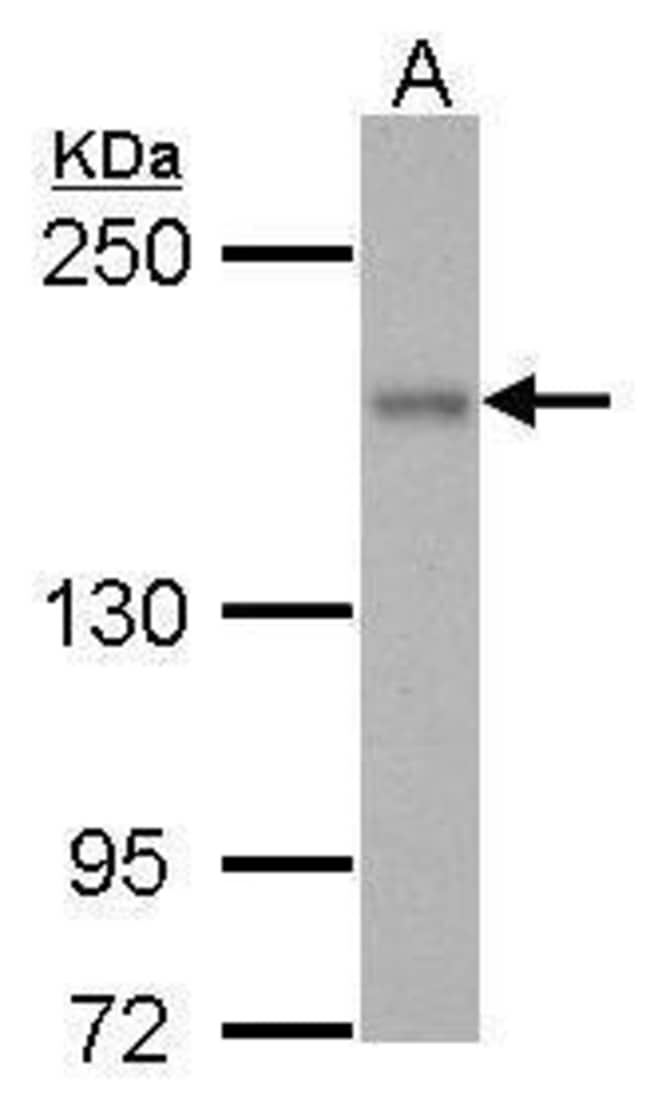 100uL Polyclonal antibody, ROCK1, host r