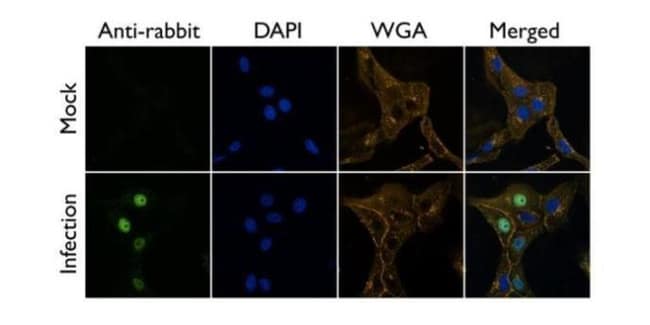 ANTI-ANTI-INFLUENZA A VIRUS PB2