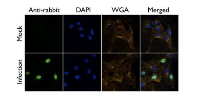 ANTI-ANTI-INFLUENZA A VIRUS PB2