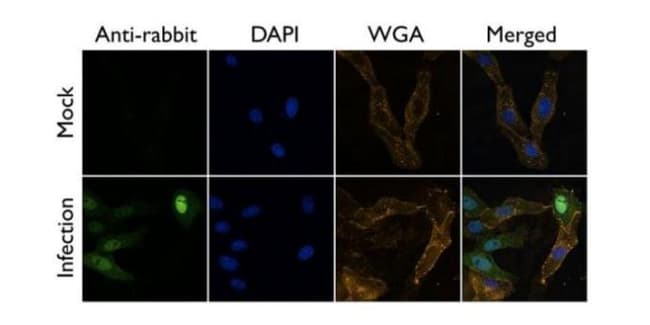100uL Polyclonal antibody, influenza A v