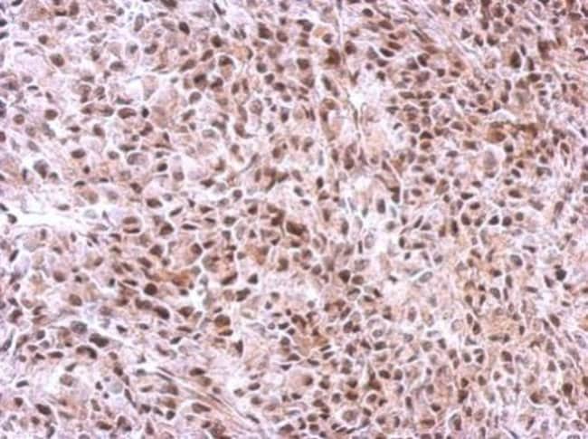 100uL Polyclonal antibody, avian Slu7, h