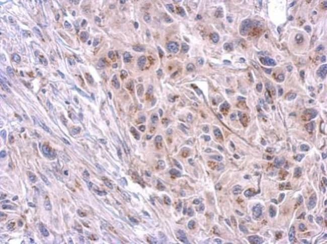 100uL Polyclonal antibody, TTC39B, host
