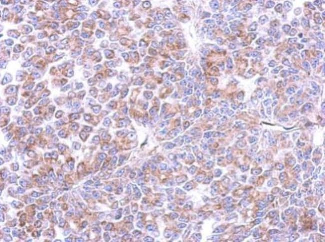 100uL Polyclonal antibody, cyclin I, hos