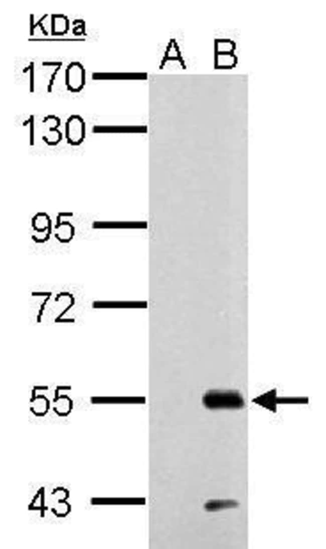 100uL Polyclonal antibody, C9orf102, hos