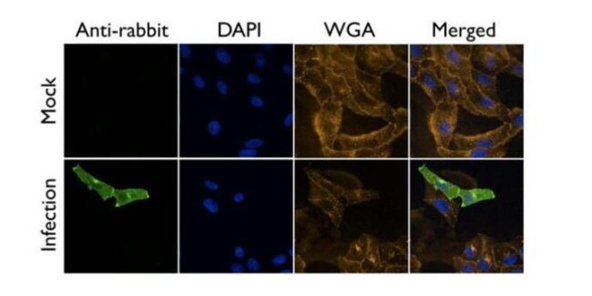 100uL Polyclonal antibody, influenza A v