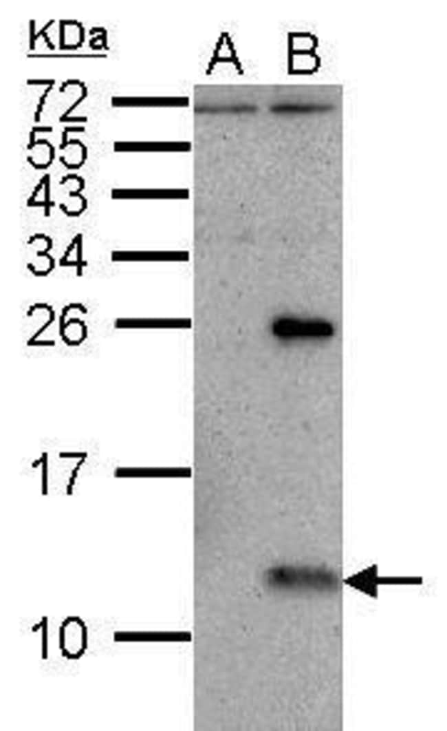 100uL Polyclonal antibody, influenza A v