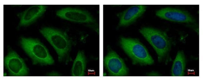 100uL Polyclonal antibody, ARD1A, host r