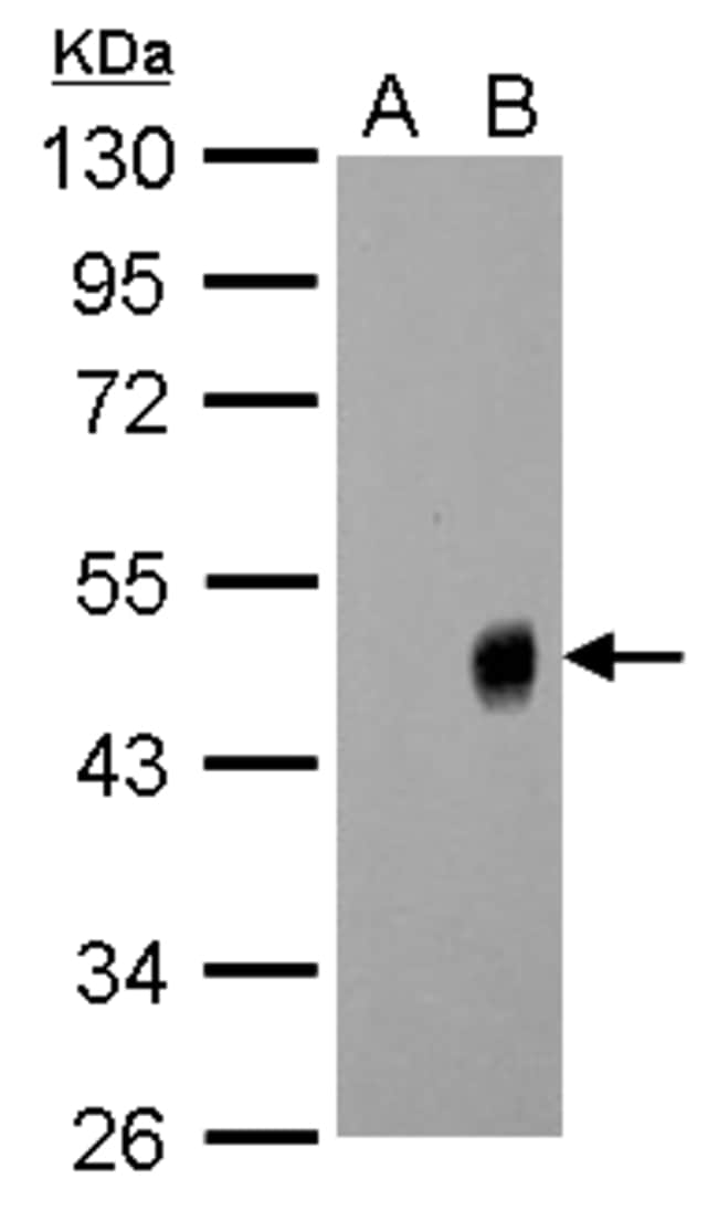 ANTI-INFLUENZA A VIRUS H1N1 NA