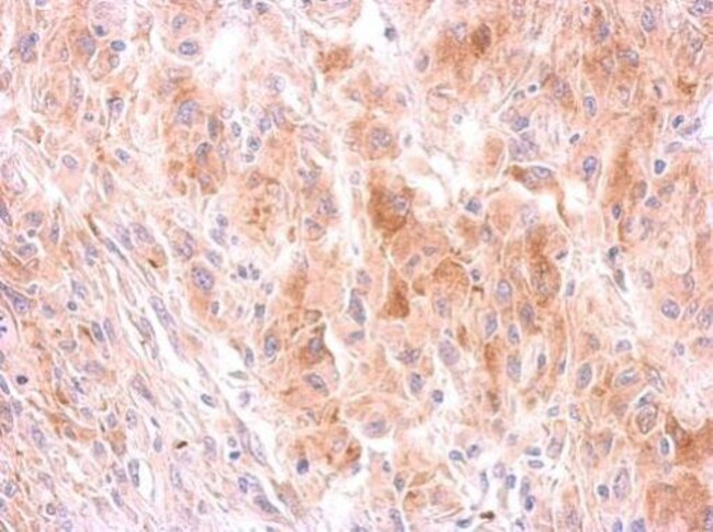 100uL Polyclonal antibody, GRB10, host r