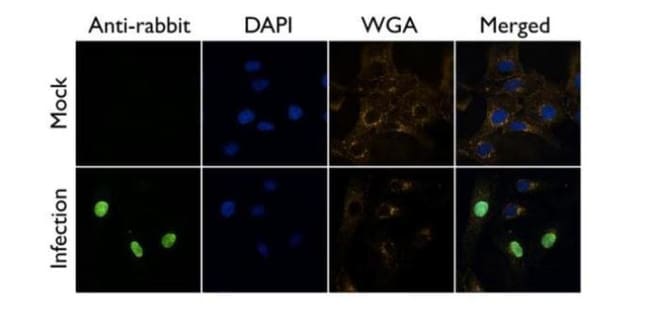 100uL Polyclonal antibody, influenza A v