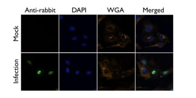 100uL Polyclonal antibody, influenza A v