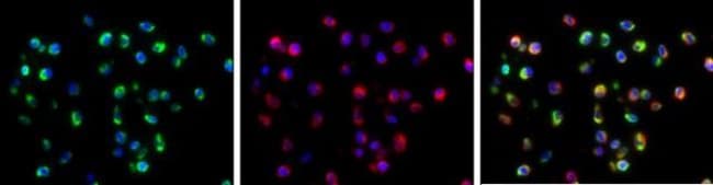 ANTI-ENVELOPE PROTEIN (DENGUE VIRUS 2)