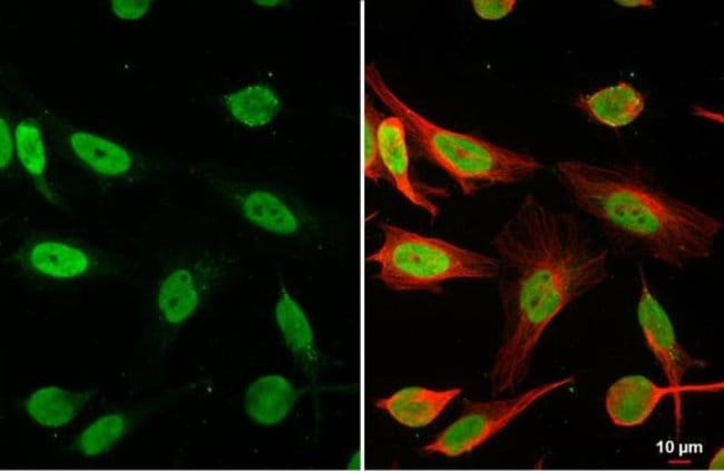 100uL Polyclonal antibody, HMGB1, host r