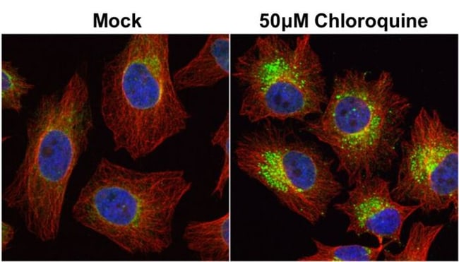 100uL Polyclonal antibody, LC3B1+LC3B2,