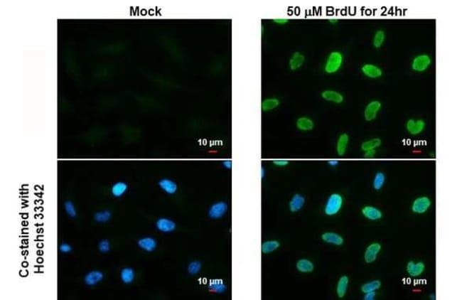 100uL Polyclonal antibody, BrdU, host ra
