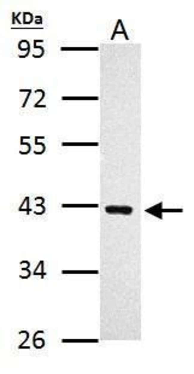100uL Polyclonal antibody, PRMT1, host r
