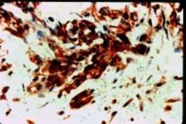 500uL Polyclonal antibody, FLT-1/VEGFR1,